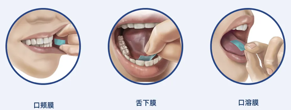 Oral film formulations: A new frontier in high-end innovative preparations.